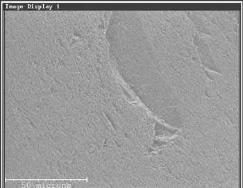Fischer Filtersand ohne Bakterien